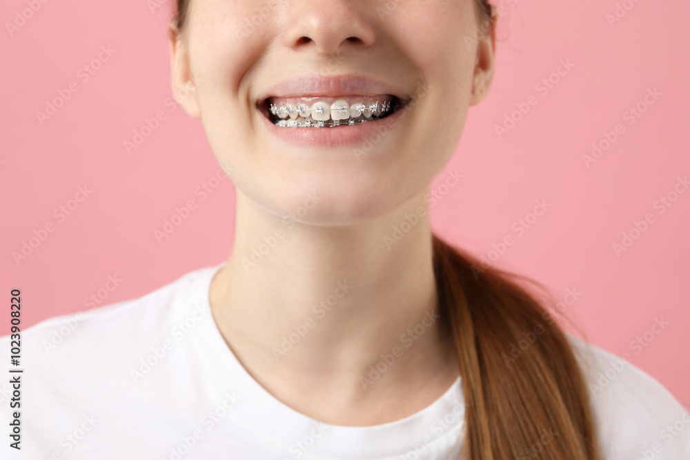 Girl with braces on pink background, closeup Girl with braces on pink background, closeup