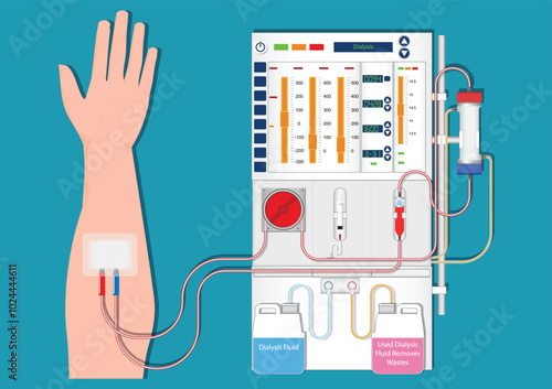 Hemodialysis or hemo is one type of dialysis treatment.