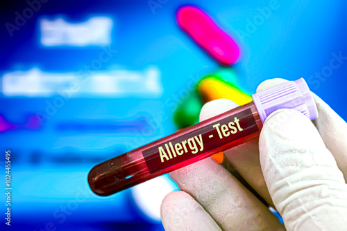 Biological specimen (blood) in vacuum tube for pathological analysis. Medical laboratory various testing concept. health care conceptional images photo