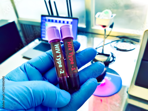 Biological specimen (blood) in vacuum tube for pathological analysis. Medical laboratory various testing concept. health care conceptional images photo