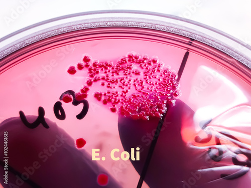 Bilde på lerret Medical technologist holds Bacteria culture growth on chromogenic media plate in Microbiology Laboratory, Escherichia coli (E