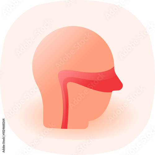 Rhinitis