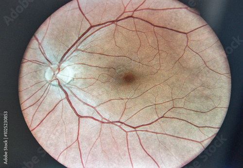 Wide angle retinal fundus imaging closeup. photo