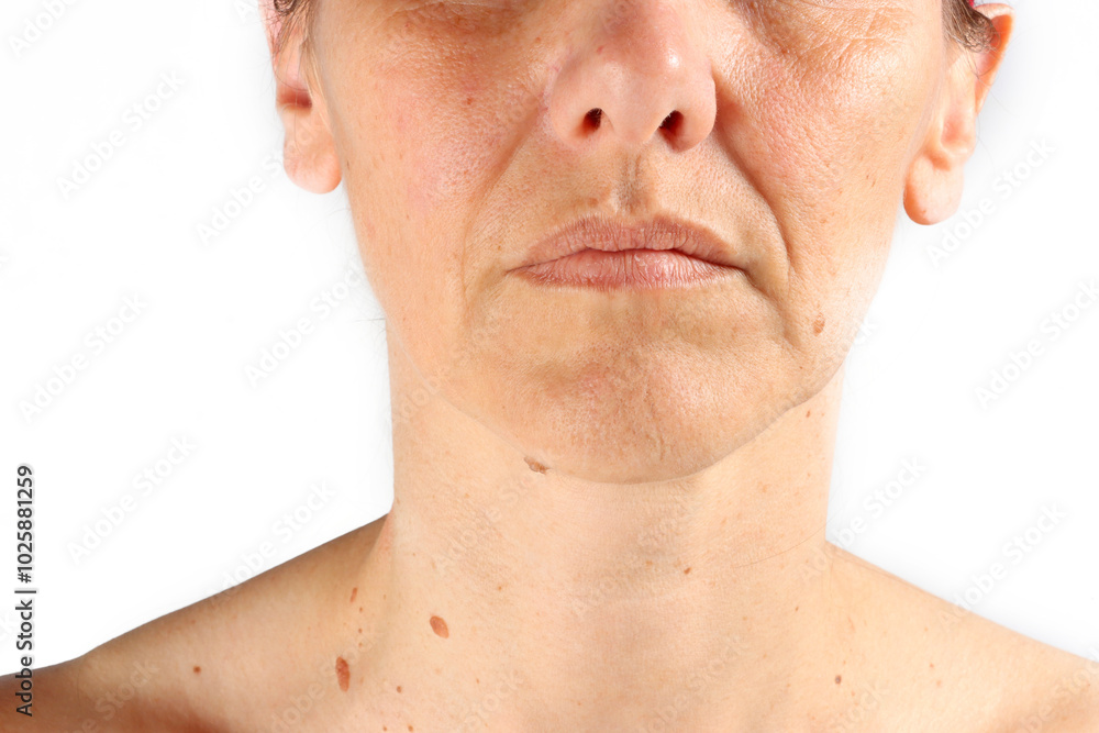 close-up on the wrinkles around the mouth of a 45-year-old woman , nasolabial folds close-up on the wrinkles around the mouth of a 45-year-old woman , nasolabial folds