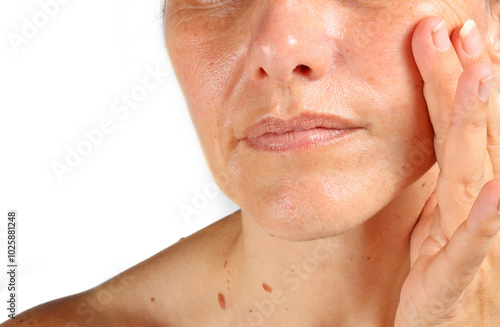 close-up on the wrinkles around the mouth of a 45-year-old woman , nasolabial folds