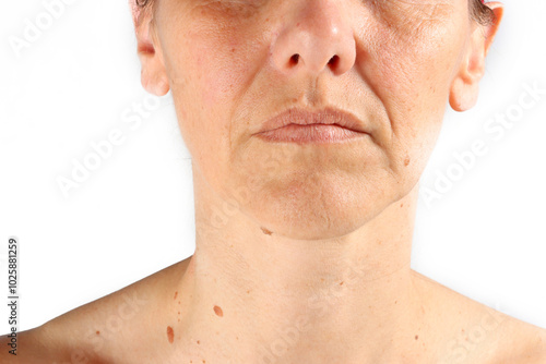 close-up on the wrinkles around the mouth of a 45-year-old woman , nasolabial folds