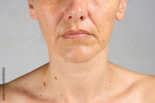 close-up on the wrinkles around the mouth of a 45-year-old woman , nasolabial folds