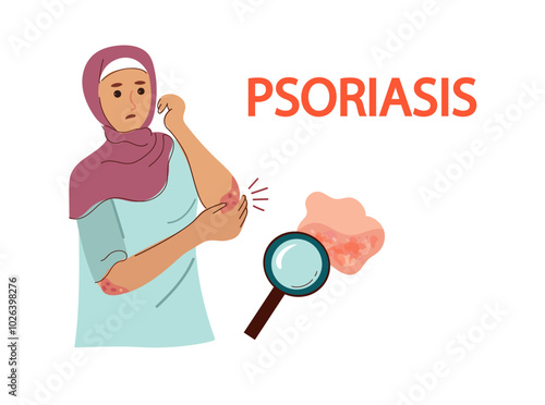 Muslim woman in hijab suffers  from psoriasis.  Psoriasis infographic. Human skin infection psoriasis diagnosis. Vector hand drawn flat illustration 