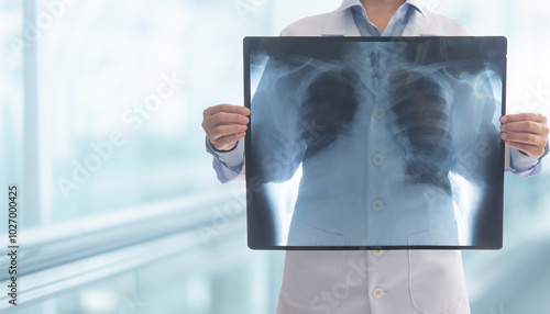 Obraz na plátně Doctor radiology looking chest or lung x-ray images at hospital ward to diagnose pneumonia or inflamed lungs
