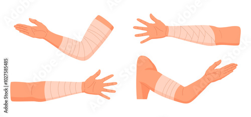Injured human arms. Bandaged elbows and forearms, damaged arm parts, emergency treatment for bones fractures and sprains flat vector illustration set. Physical injury bandages