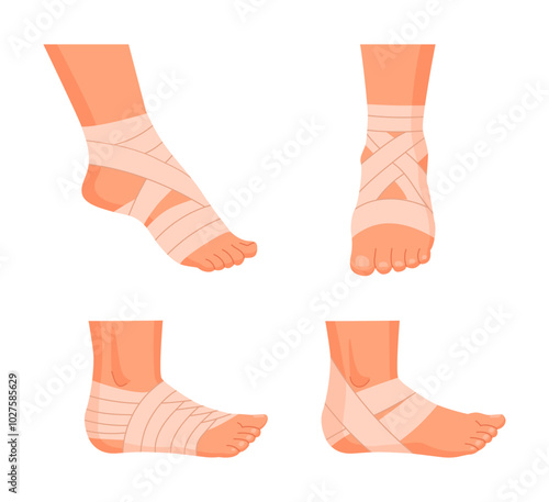 Injured human feet. Bandaged ankles, damaged legs parts, emergency treatment for sprains and bones fractures flat vector illustration set. Physical injury bandages