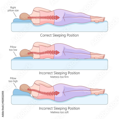 Obraz na plátně proper and improper side sleeping positions with spine alignment, the effects of pillow height and mattress firmness diagram hand drawn raster illustration
