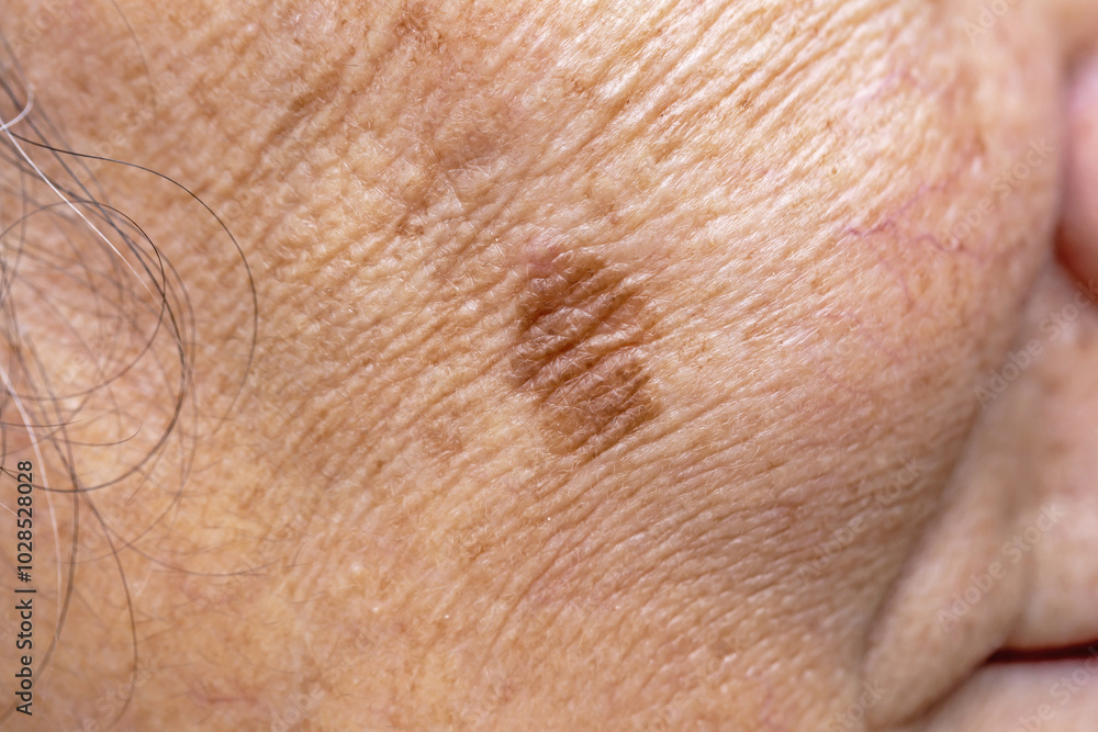 Woman's problematic skin pore and dark spots on the face Woman's problematic skin pore and dark spots on the face