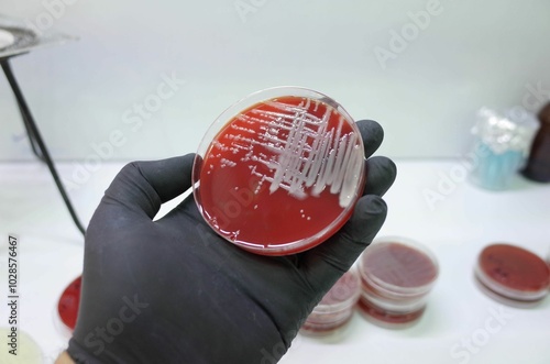 Close-up of a gloved hand holding a petri dish with bacterial, fungal cultures on red agar medium photo