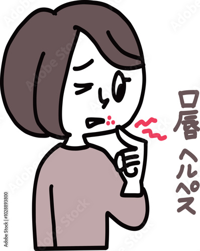 口唇ヘルペス