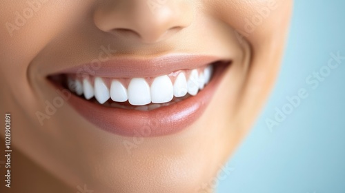 Close up of a woman's smile, showcasing perfect white teeth.