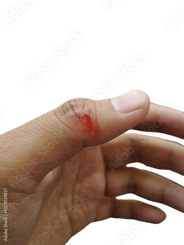 Close-up hand injuries, accidental cuts with knives, real bloody hands isolated on white background