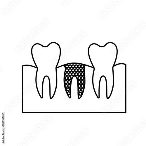 bone graft icon