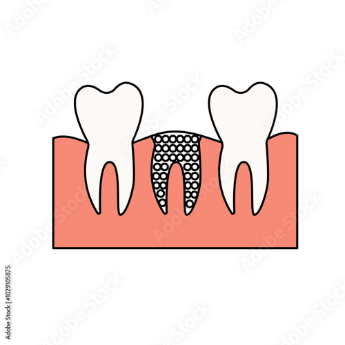 bone graft icon