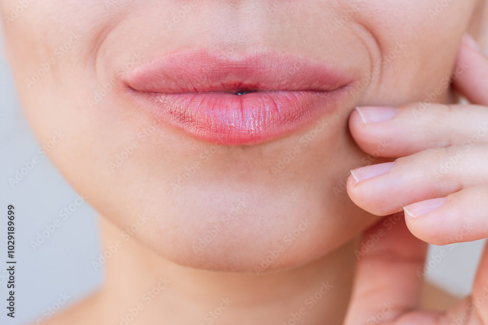 Obraz premium Close up of young caucasian woman's face with perfect lips after lip enhancement. The girl demonstrating the result of lip augmentation. Injection of filler in lips