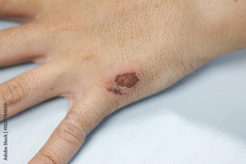 Naklejka premium Wound and Scar on different parts of the body, Caused by an accident. 