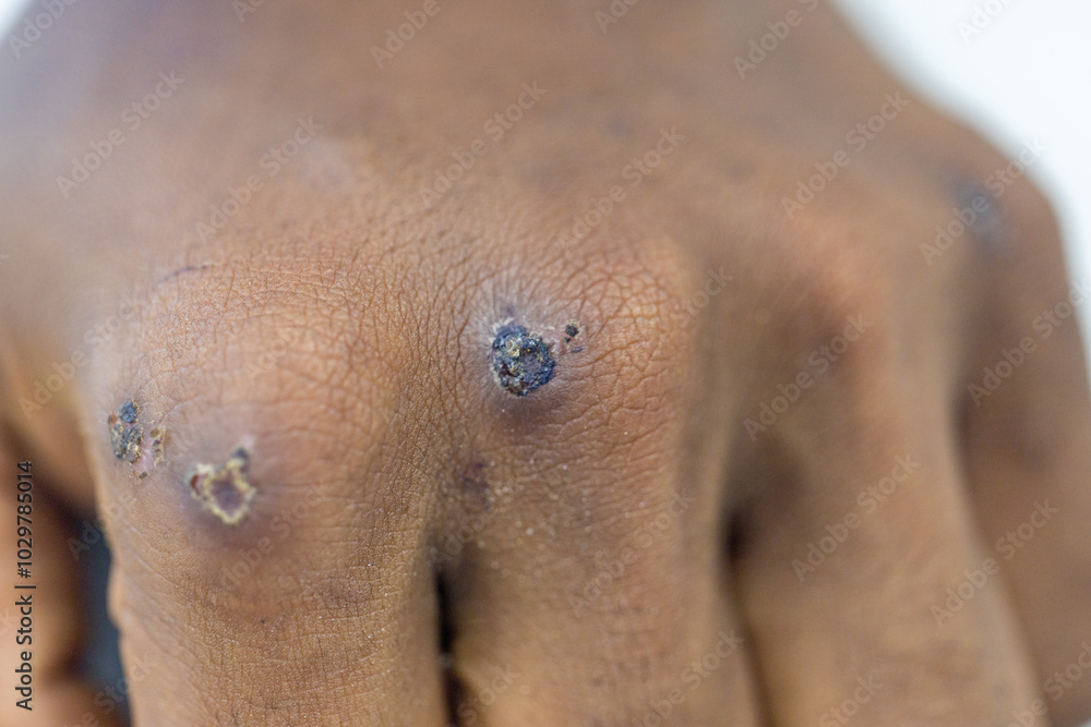 Wound and Scar on different parts of the body, Caused by an accident. Wound and Scar on different parts of the body, Caused by an accident.