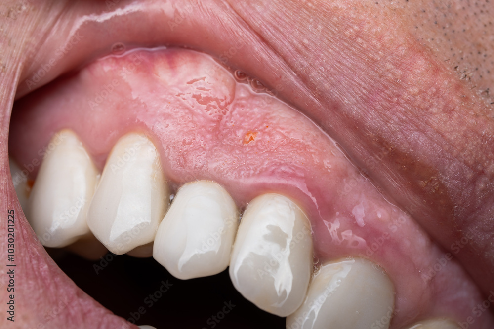 Caucasian man open mouth with teeth and gums, macro close up shot Caucasian man open mouth with teeth and gums, macro close up shot