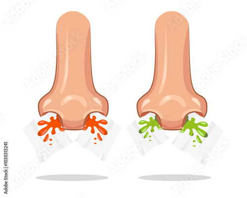 Nose bleeds and runny nose with tissue. Close Up Human Nose icon. Vector isolated on white background.