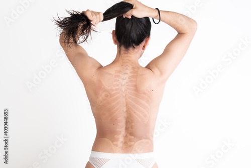 Woman with lumbar scoliosis, rehabilitation, back pain, posture, spine, physical discomfort