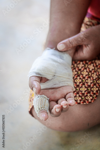 Hand of woman injured and bandaged