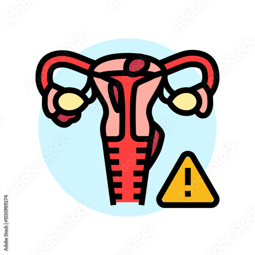 endometriosis woman disease color icon vector. endometriosis woman disease sign. isolated symbol illustration