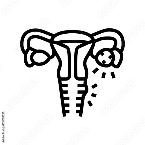 pelvic inflammatory woman disease line icon vector. pelvic inflammatory woman disease sign. isolated contour symbol black illustration