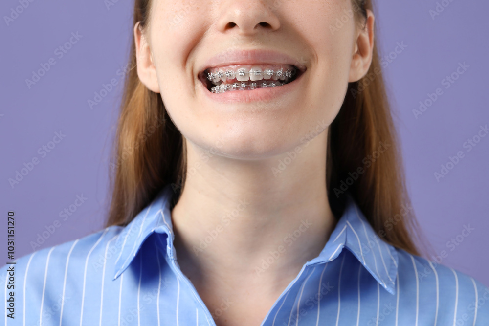 Girl with braces on purple background, closeup