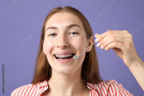 Girl with braces using dental mirror on purple background photo