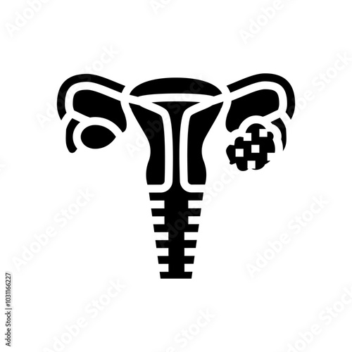 polycystic ovary syndrome woman disease glyph icon vector. polycystic ovary syndrome woman disease sign. isolated symbol illustration