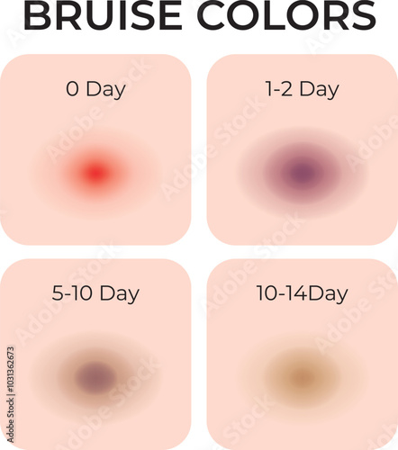 Bruise Colors Science Design Vector Illustration Diagram