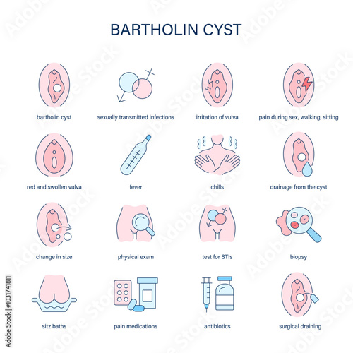 Bartholin Cyst symptoms, diagnostic and treatment vector icons. Medical icons.