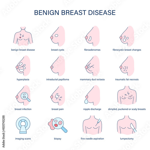 Benign Breast Disease symptoms, diagnostic and treatment vector icons. Medical icons.