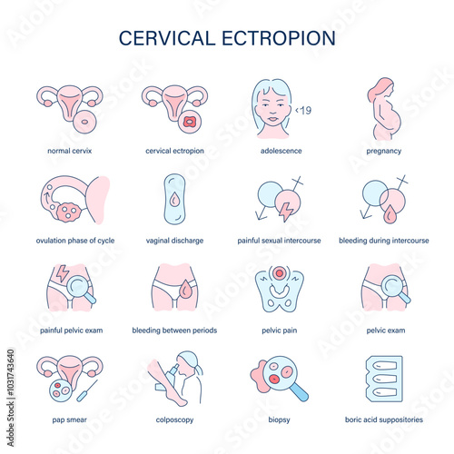 Cervical Ectropion symptoms, diagnostic and treatment vector icons. Medical icons.