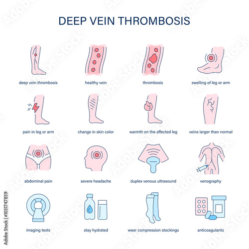 Deep Vein Thrombosis symptoms, diagnostic and treatment vector icons. Medical icons.