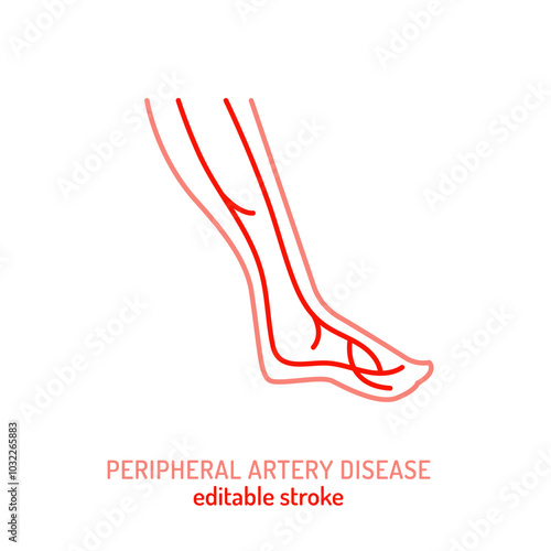 Peripheral artery disease outline icon. PAD linear pictogram.