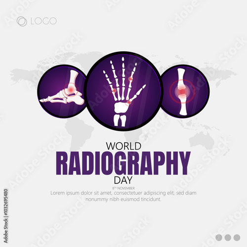 Radiography Day, observed on November 8th, celebrates the discovery of X-rays by Wilhelm Conrad Roentgen in 1895.