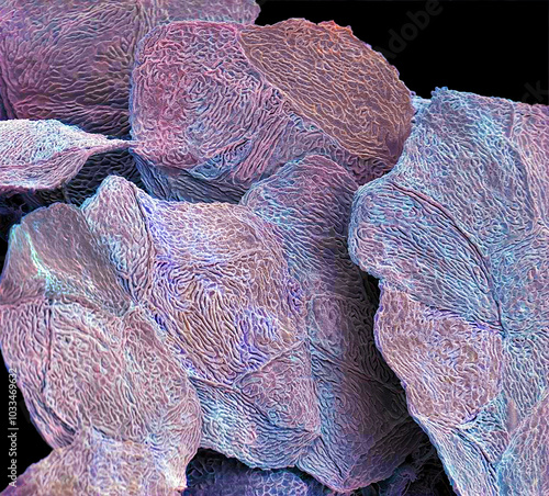 Skin cells, SEM photo