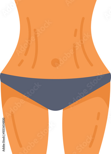 Closeup of a woman's belly with stretch marks, highlighting a common postpartum body change