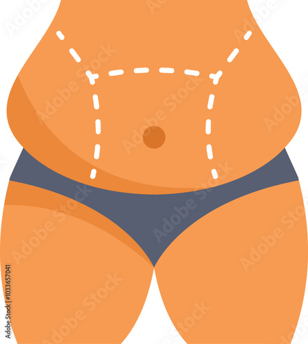 Woman body with lines showing liposuction surgery marks, concept for weight loss and plastic surgery