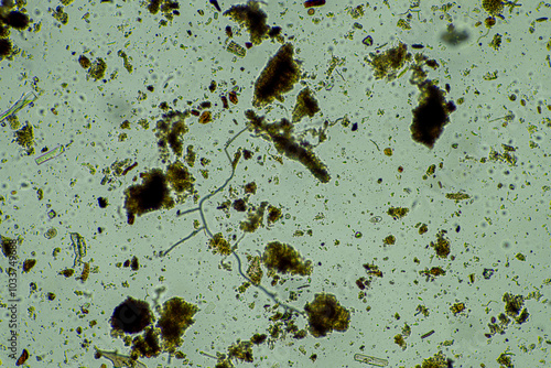 soil fungi storing carbon in the soil. testate amoebae and bacteria cycling nutrients. regenerative agriculture sustainable practices growing healthy food on farms and in crops photo