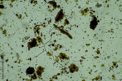 soil fungi storing carbon in the soil. testate amoebae and bacteria cycling nutrients. regenerative agriculture sustainable practices growing healthy food on farms and in crops photo