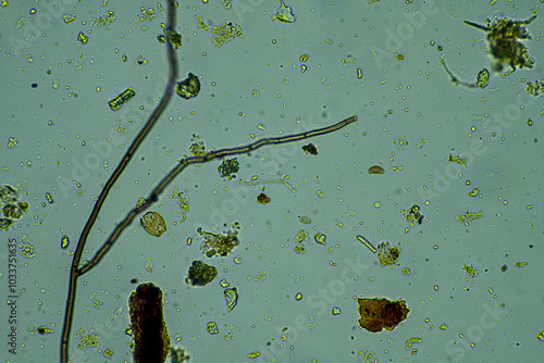 soil fungi storing carbon in the soil. testate amoebae and bacteria cycling nutrients. regenerative agriculture sustainable practices growing healthy food on farms and in crops photo