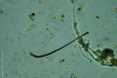 soil fungi storing carbon in the soil. testate amoebae and bacteria cycling nutrients. regenerative agriculture sustainable practices growing healthy food on farms and in crops photo