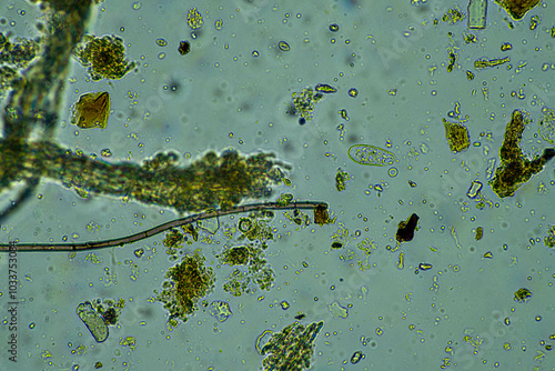 soil fungi storing carbon in the soil. testate amoebae and bacteria cycling nutrients. regenerative agriculture sustainable practices growing healthy food on farms and in crops photo